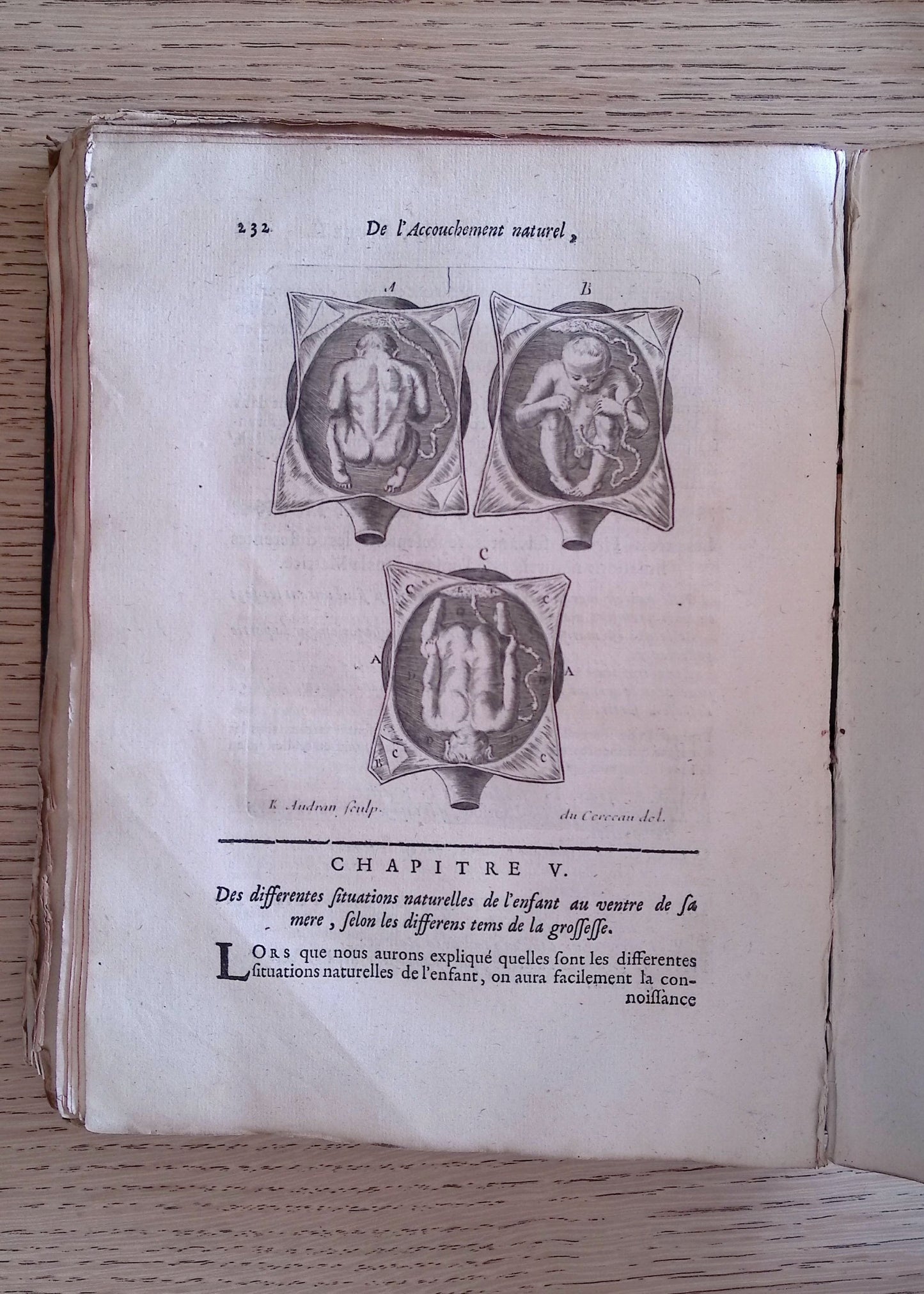 Traite Des Maladies Des Femmes Grosses, et De Celles Qui Sont Accouchees. Enseignant La Bonne & Veritable Methode Pour Bien Aider Les Femmes et Leurs Accouchermens Naturels... etc (Septieme Edition. Tome Premier. (Vol. I only, of 2).
