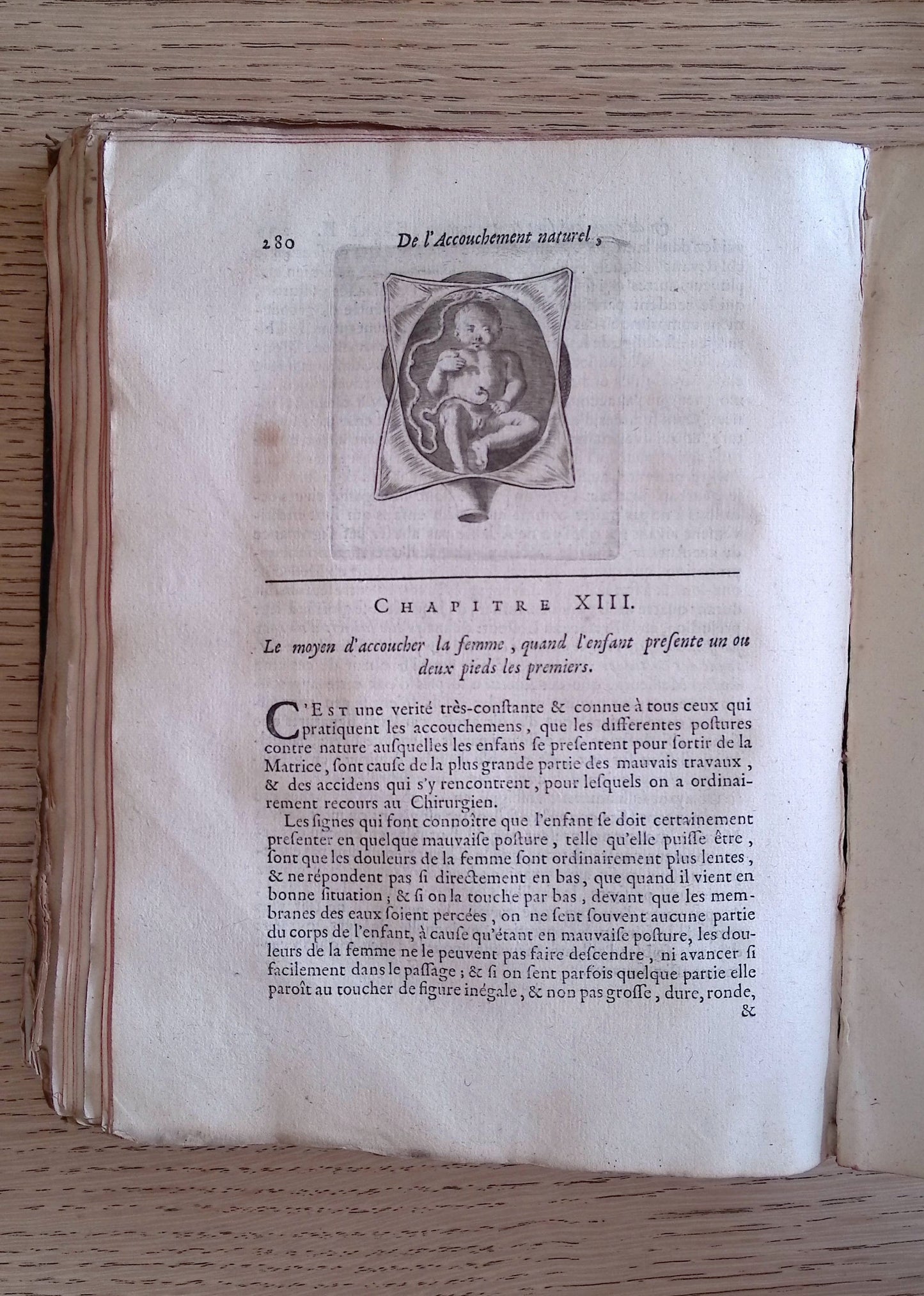 Traite Des Maladies Des Femmes Grosses, et De Celles Qui Sont Accouchees. Enseignant La Bonne & Veritable Methode Pour Bien Aider Les Femmes et Leurs Accouchermens Naturels... etc (Septieme Edition. Tome Premier. (Vol. I only, of 2).